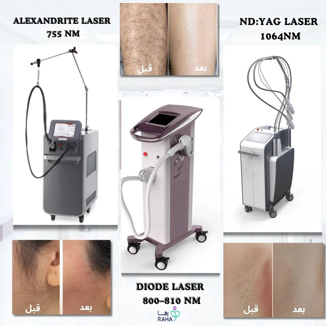 أهم التقنيات المستخدمة في مراكز الليزر الحديثة&nbsp;